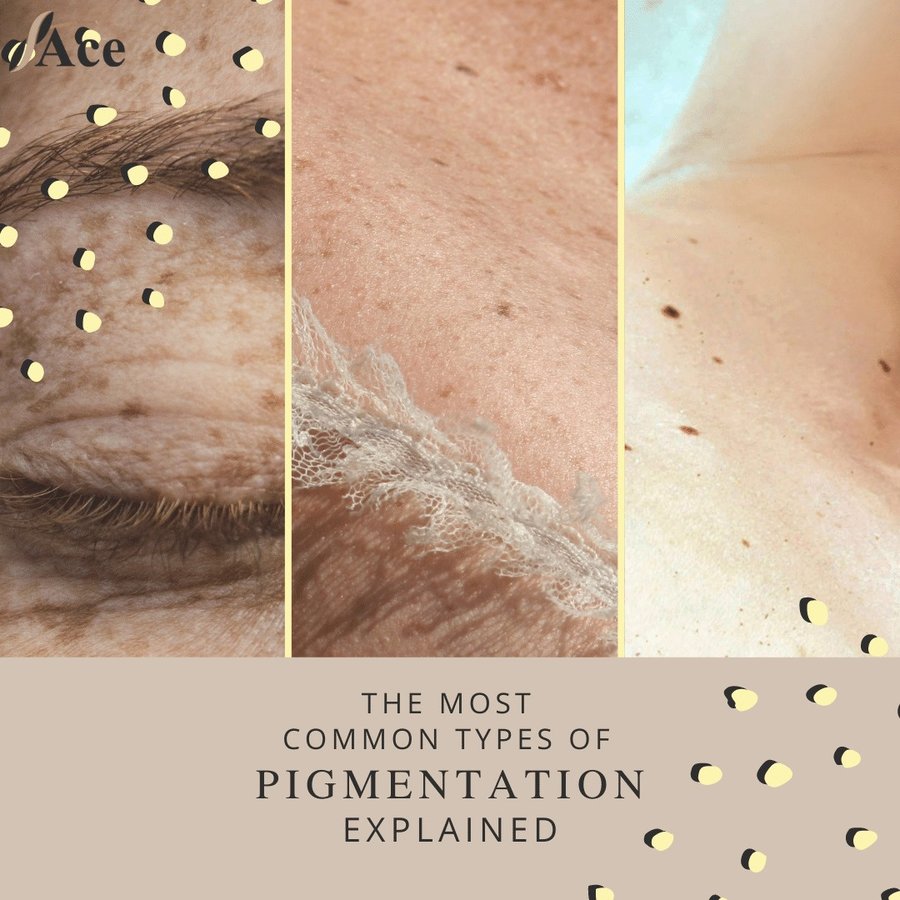 Ace Aesthetics - Ace Aesthetics